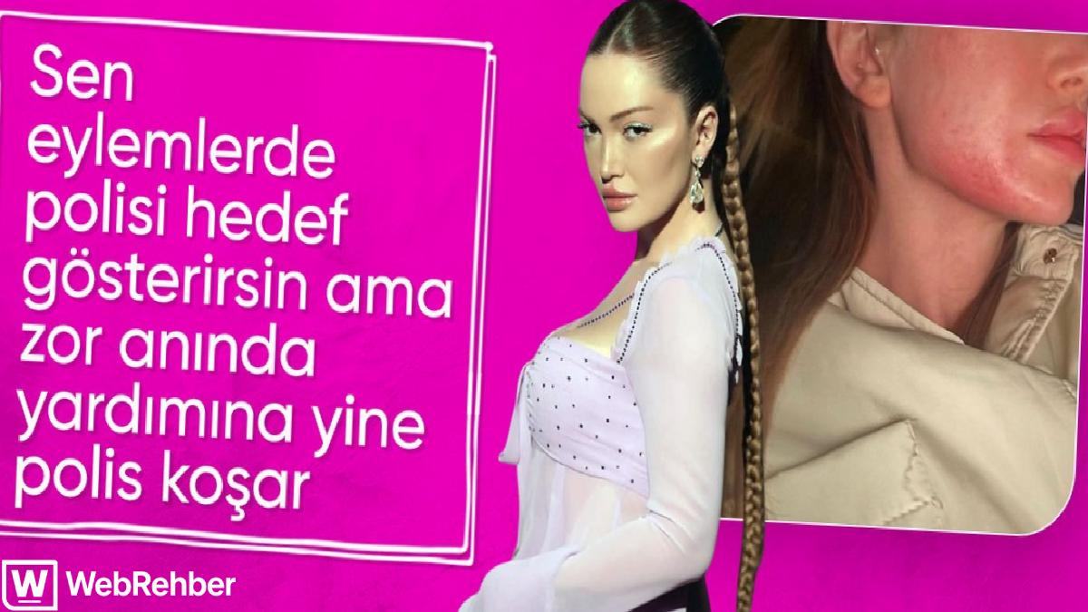 Eski sevgilisinden şiddet gören Danla Bilic, KADES’ten yardım çağırdı