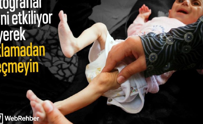 Gazze’de acı tablo: Açlık krizi derinleşiyor