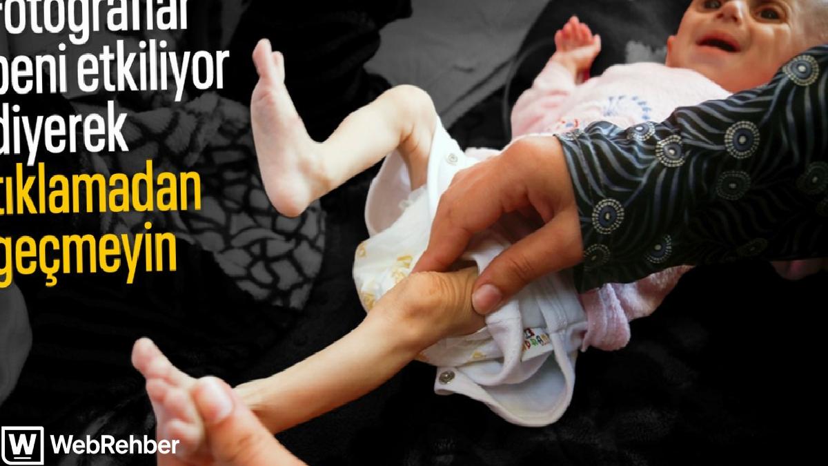 Gazze’de acı tablo: Açlık krizi derinleşiyor