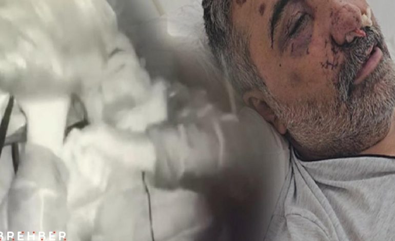 İngiliz boksörün öldüresiye dövdüğü taksici ilk kez konuştu! ‘Neden yaptığını anlamadım, beni öpmeye ve ısırmaya başladı’