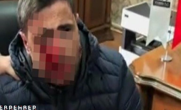 Trabzon’da veli, okulda öğretmeni darbetti