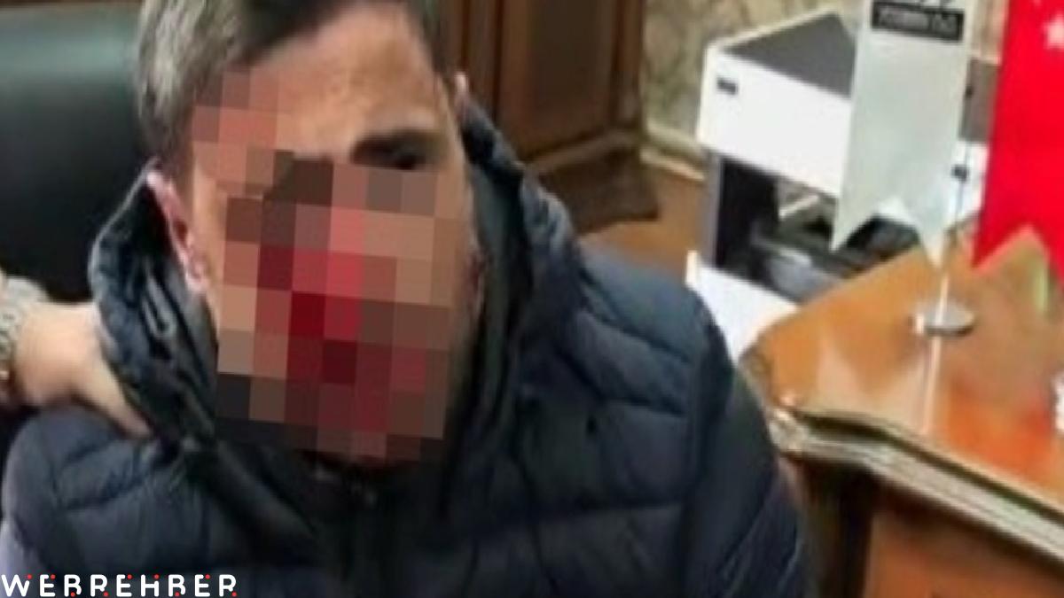 Trabzon’da veli, okulda öğretmeni darbetti