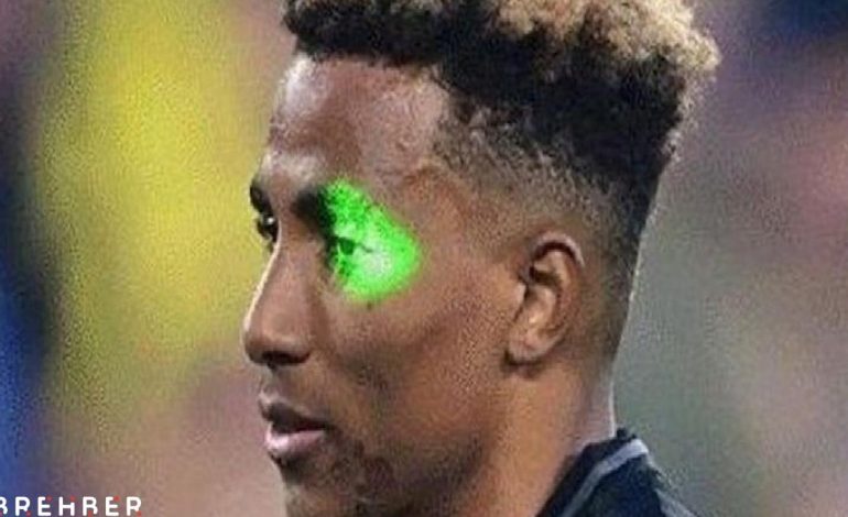 Derbinin ardından lazer gözaltısı