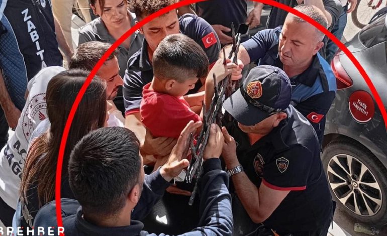 Dut yemek isteyen çocuğun eli korkuluk demirine saplandı
