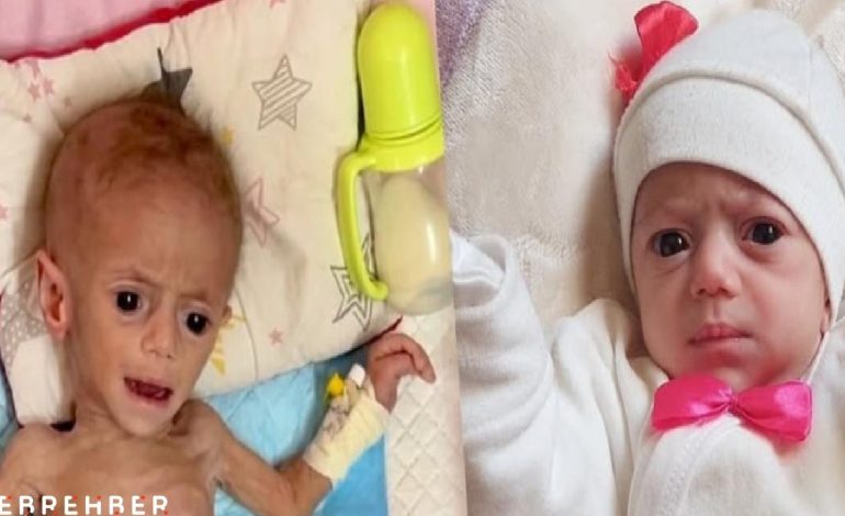 Gazze’de beş aylık Suvar Aşur, yetersiz beslenme yüzünden ölümle burun buruna