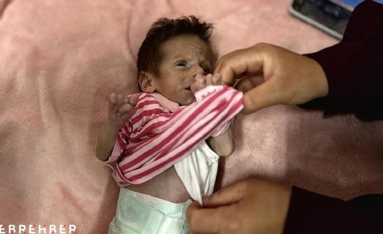 Gazze’de bir bebek daha açlık yüzünden can vermek üzere