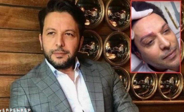 Nihat Doğan estetik yaptırdı, sosyal medyanın diline düştü!